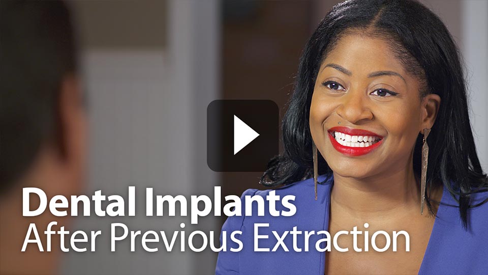 Dental Implants After Previous Extraction